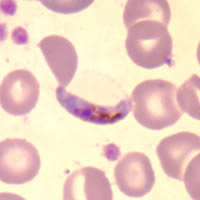 image of Plasmodium falciparum